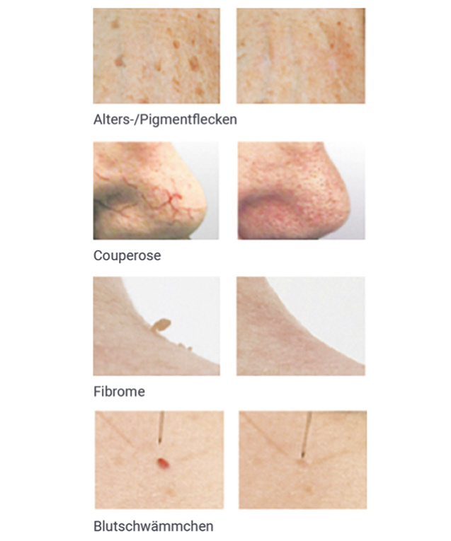 Typische Anwendungsfälle des Verfahrens