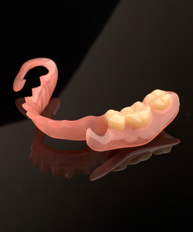 Puro.flexx-Prothese für ersetzte Zähne 35/36/37, abgestützt im 4.Quadrant, Klammern an 34 und 47